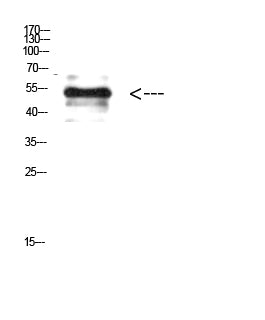 Vimentin (Phospho-Tyr38) Colorimetric Cell-Based ELISA Kit