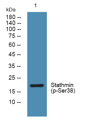 Stathmin (Phospho-Ser38) Colorimetric Cell-Based ELISA Kit