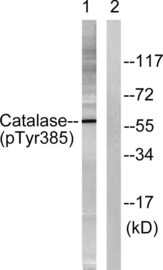 Catalase (Phospho-Tyr386) Colorimetric Cell-Based ELISA Kit