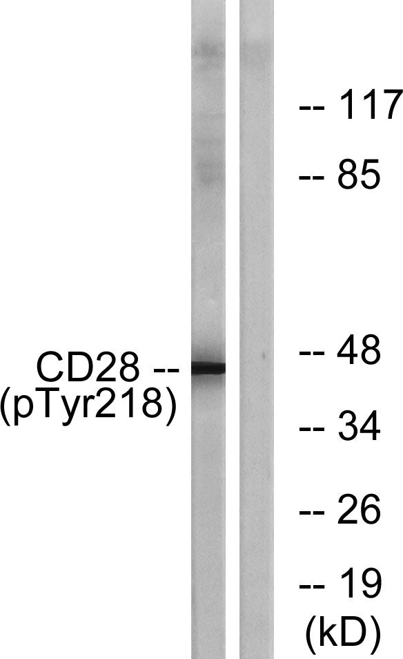 CD28 (Phospho-Tyr218) Colorimetric Cell-Based ELISA Kit