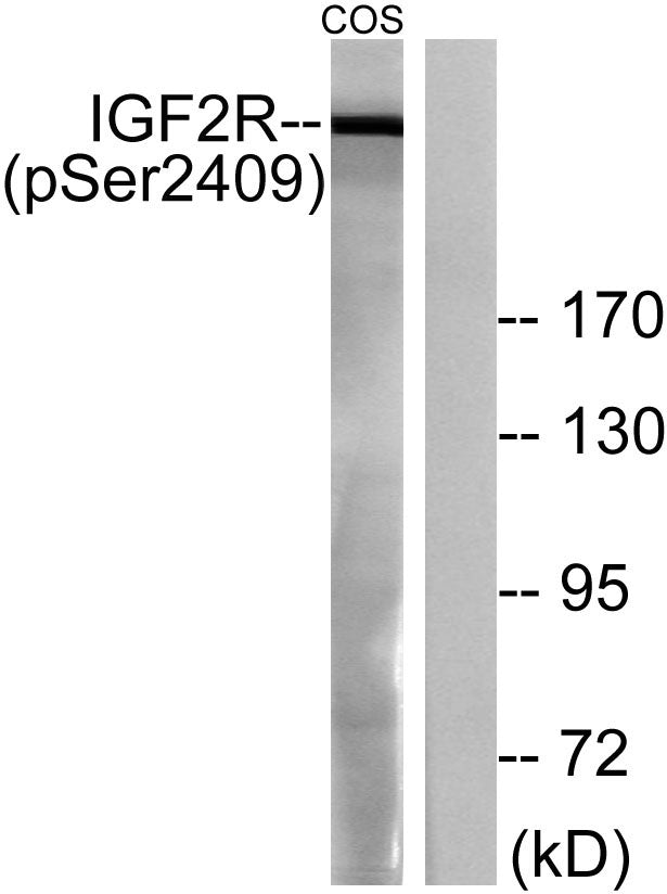 IGF-IIR (Phospho-Ser2409) Colorimetric Cell-Based ELISA Kit
