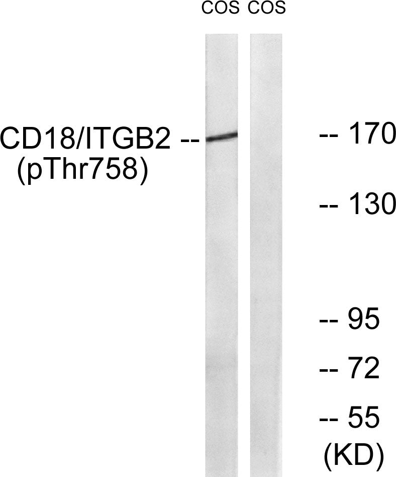 Integrin beta2 (Phospho-Thr758) Colorimetric Cell-Based ELISA Kit