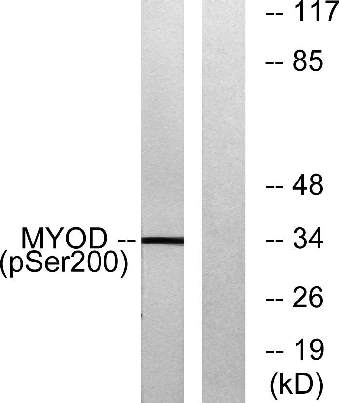MyoD (Phospho-Ser200) Colorimetric Cell-Based ELISA Kit