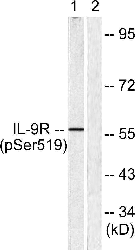 IL-9R (Phospho-Ser519) Colorimetric Cell-Based ELISA Kit