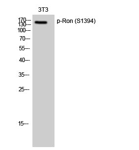 Ron (Phospho-Ser1394) Colorimetric Cell-Based ELISA Kit