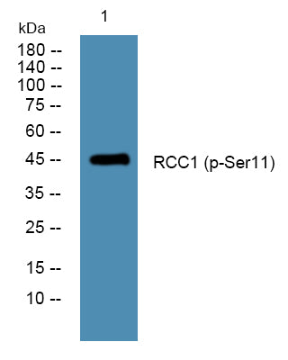 RCC1 (Phospho-Ser11) Colorimetric Cell-Based ELISA Kit
