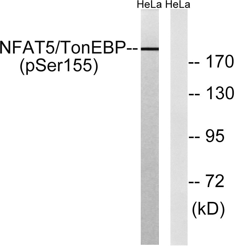 NFAT5 (Phospho-Ser155) Colorimetric Cell-Based ELISA Kit