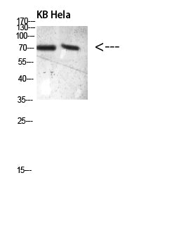 PRC1(Phospho-Thr481)Colorimetric Cell-Based ELISA Kit