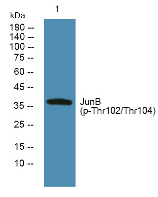 JunB (Phospho-Thr102/Thr104) Colorimetric Cell-Based ELISA Kit