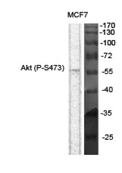 Akt (Phospho-Ser473) Colorimetric Cell-Based ELISA Kit