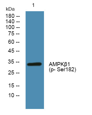 AMPKbeta1 (Phospho-Ser182) Colorimetric Cell-Based ELISA Kit