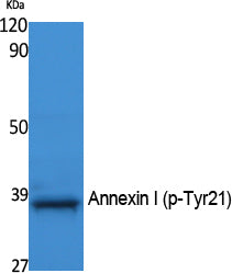 Annexin I (Phospho-Tyr21) Colorimetric Cell-Based ELISA Kit