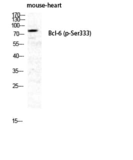 Bcl-6 (Phospho-Ser333) Colorimetric Cell-Based ELISA Kit