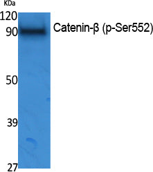 Catenin-beta (Phospho-Ser552) Colorimetric Cell-Based ELISA Kit