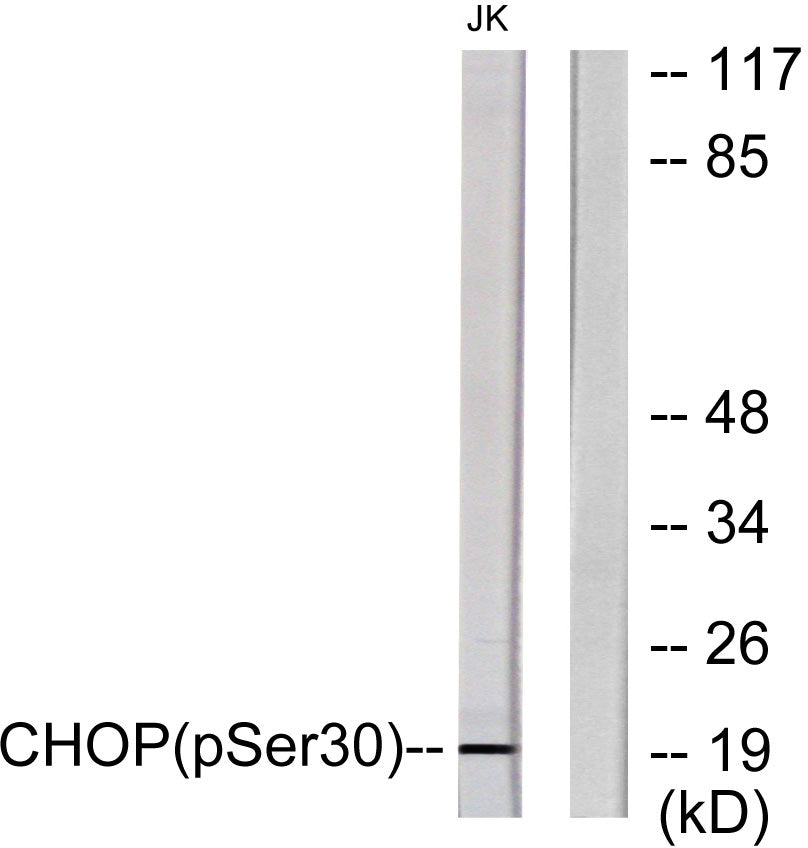 CHOP (Phospho-Ser30) Colorimetric Cell-Based ELISA Kit