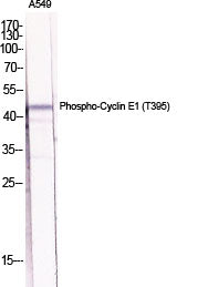 Cyclin E1 (Phospho-Thr395) Colorimetric Cell-Based ELISA Kit