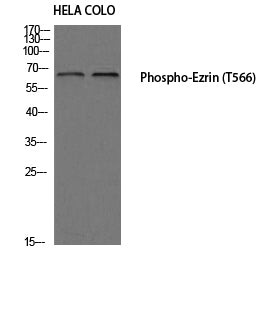 Ezrin (Phospho-Thr566) Colorimetric Cell-Based ELISA Kit