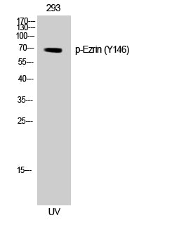 Ezrin (Phospho-Tyr146) Colorimetric Cell-Based ELISA Kit