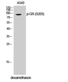 GR (Phospho-Ser203) Colorimetric Cell-Based ELISA Kit
