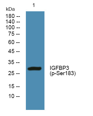 IGFBP3 (Phospho-Ser183) Colorimetric Cell-Based ELISA Kit