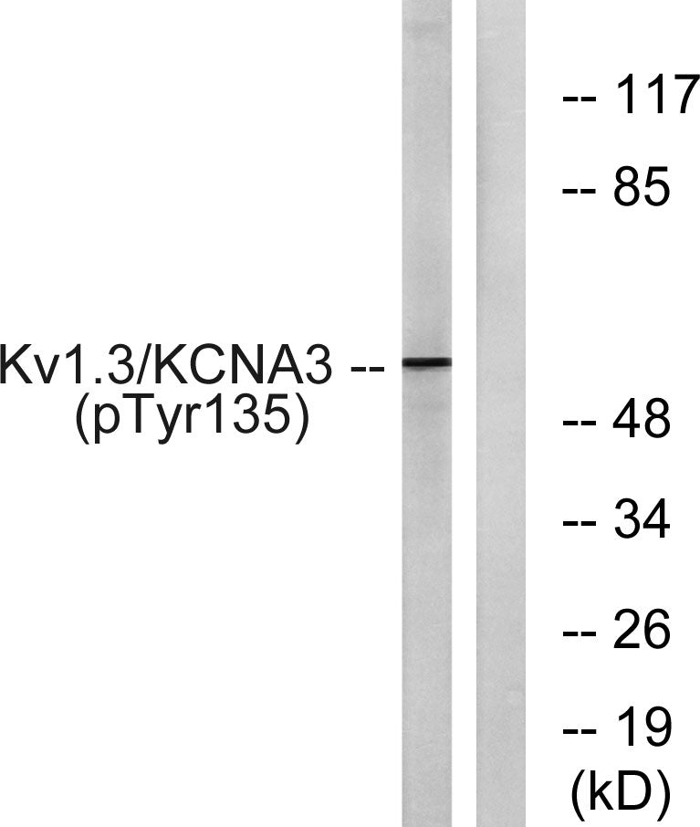 Kv1.3 (Phospho-Tyr187) Colorimetric Cell-Based ELISA Kit