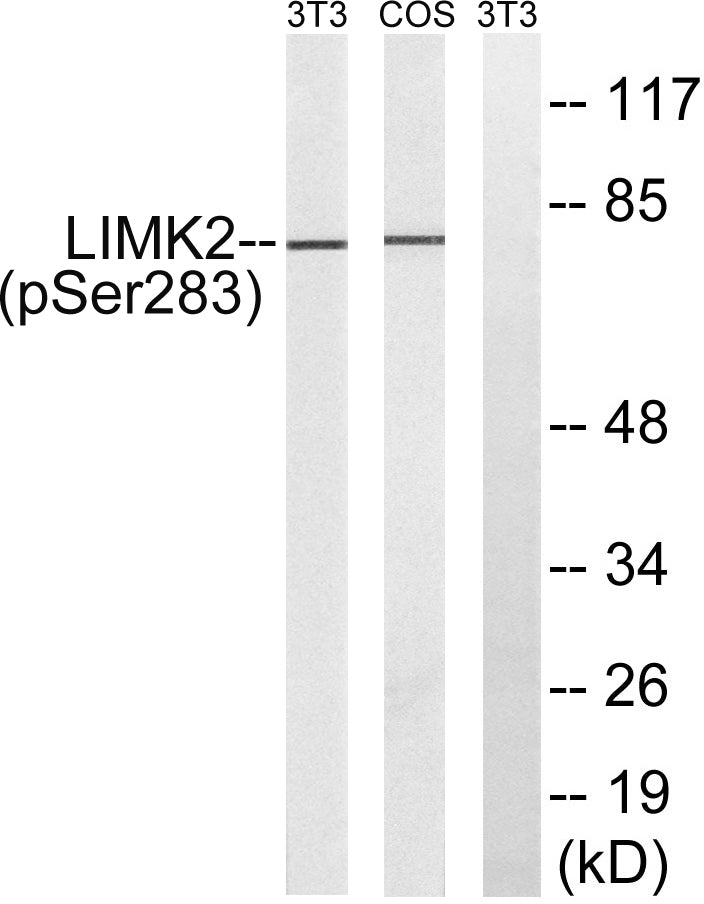 LIMK-2 (Phospho-Ser283) Colorimetric Cell-Based ELISA Kit