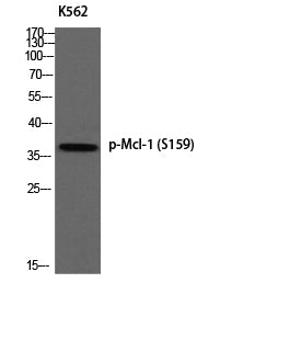 Mcl-1 (Phospho-Ser159) Colorimetric Cell-Based ELISA Kit