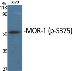 MOR-1 (Phospho-Ser375) Colorimetric Cell-Based ELISA Kit