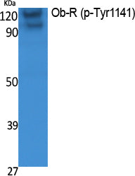 Ob-R (Phospho-Tyr1141) Colorimetric Cell-Based ELISA Kit