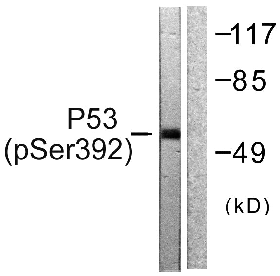 p53 (Phospho-Ser392) Colorimetric Cell-Based ELISA Kit