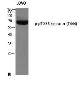 p70 S6 kinase alpha (Phospho-Thr444) Colorimetric Cell-Based ELISA Kit
