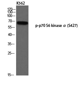 p70 S6 kinase alpha (Phospho-Ser427) Colorimetric Cell-Based ELISA Kit