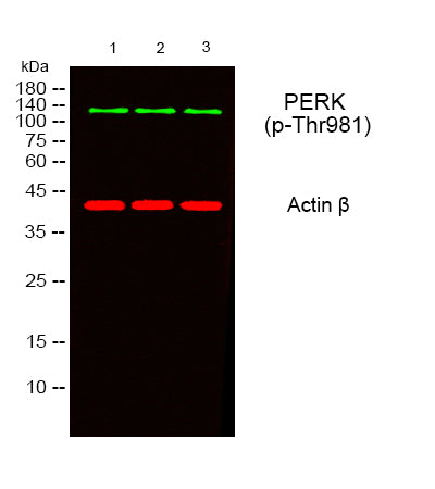 PERK (Phospho-Thr981) Colorimetric Cell-Based ELISA Kit