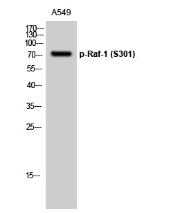 Raf-1 (Phospho-Ser301) Colorimetric Cell-Based ELISA Kit