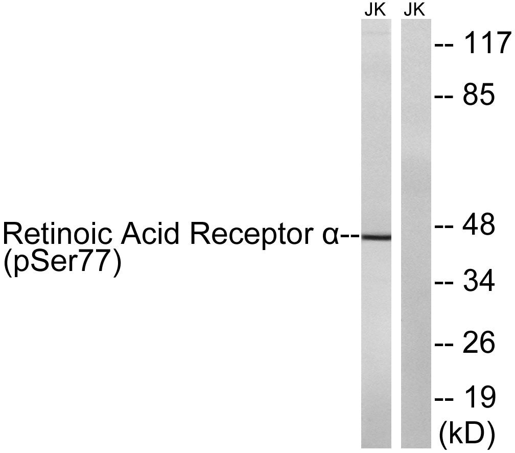 RARalpha (Phospho-Ser77) Colorimetric Cell-Based ELISA Kit