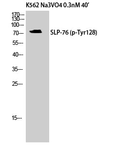 SLP-76 (Phospho-Tyr128) Colorimetric Cell-Based ELISA Kit