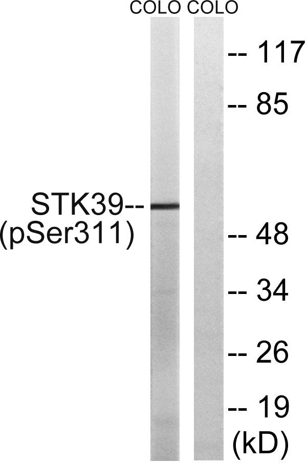 SPAK (Phospho-Ser309) Colorimetric Cell-Based ELISA Kit