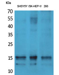 Synuclein-alpha (Phospho-Tyr125) Colorimetric Cell-Based ELISA Kit