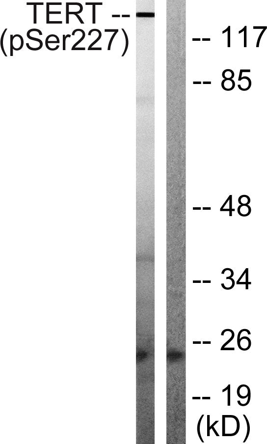 TERT (Phospho-Ser227) Colorimetric Cell-Based ELISA Kit
