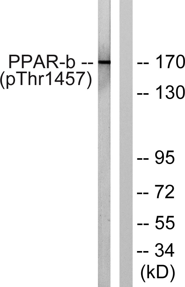 TRAP220 (Phospho-Thr1457) Colorimetric Cell-Based ELISA Kit