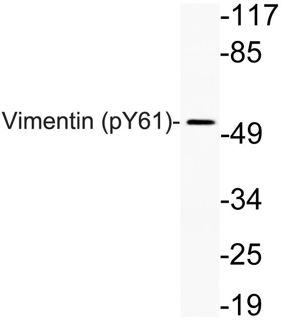 Vimentin (Phospho-Tyr61) Colorimetric Cell-Based ELISA Kit