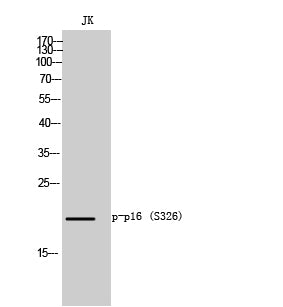 p16-INK4a (Phospho-Ser152) Colorimetric Cell-Based ELISA Kit