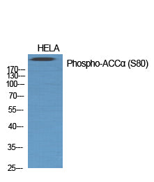 ACCalpha (Phospho-Ser80) Colorimetric Cell-Based ELISA Kit
