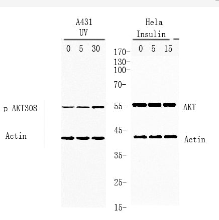 Akt (Phospho-Thr308) Colorimetric Cell-Based ELISA Kit