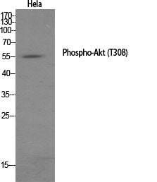 Akt (Phospho-Thr308) Colorimetric Cell-Based ELISA Kit