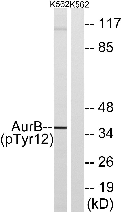 ARK-2 (Phospho-Tyr12) Colorimetric Cell-Based ELISA Kit