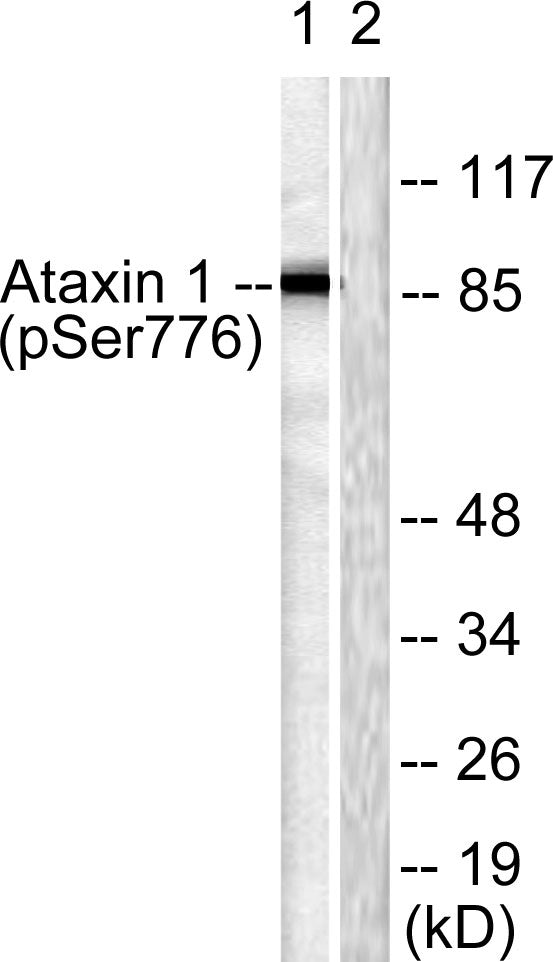 Ataxin-1 (Phospho-Ser776) Colorimetric Cell-Based ELISA Kit
