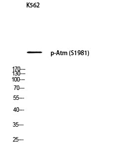 Atm (Phospho-Ser1981) Colorimetric Cell-Based ELISA Kit