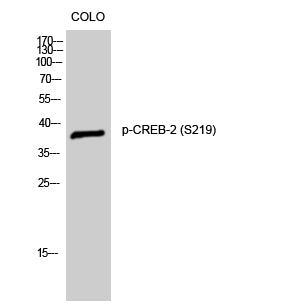 CREB-2 (Phospho-Ser219) Colorimetric Cell-Based ELISA Kit