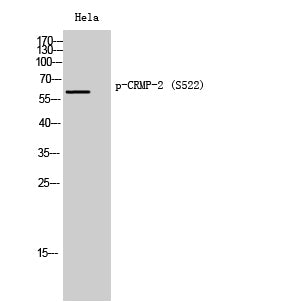 CRMP-2 (Phospho-Ser522) Colorimetric Cell-Based ELISA Kit